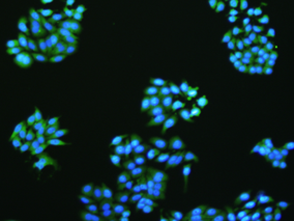 Immunofluorescence analysis of McF7 cells using AMPK alpha2 Polyclonal Antibody at dilution of 1:100. Cat. No. RD70140A