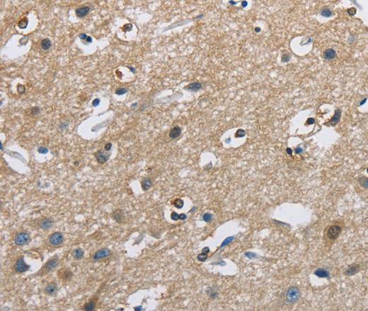 Immunohistochemistry of paraffin-embedded Human brain  using CAB39L Polyclonal Antibody at dilution of 1:40