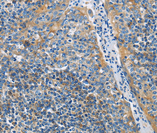 Immunohistochemistry of paraffin-embedded Human tonsil tissue using CD272 Polyclonal Antibody at dilution 1:30