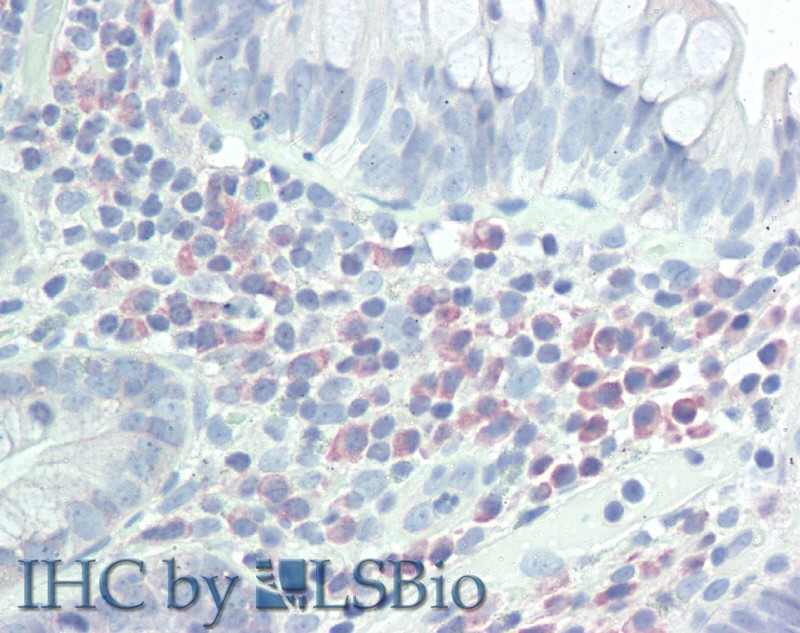 Immunohistochemistry of paraffin-embedded Small Intestine tissue using CD272 Polyclonal Antibody at dilution of 1:50 .