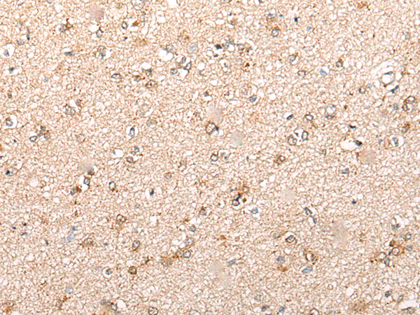 Immunohistochemistry of paraffin-embedded Human brain tissue  using CYP11B2 Polyclonal Antibody at dilution of 1:70(×200)