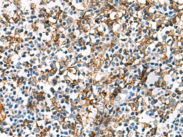 Immunohistochemistry of paraffin-embedded Human tonsil tissue  using HLA-DRA Polyclonal Antibody at dilution of 1:30(×200)