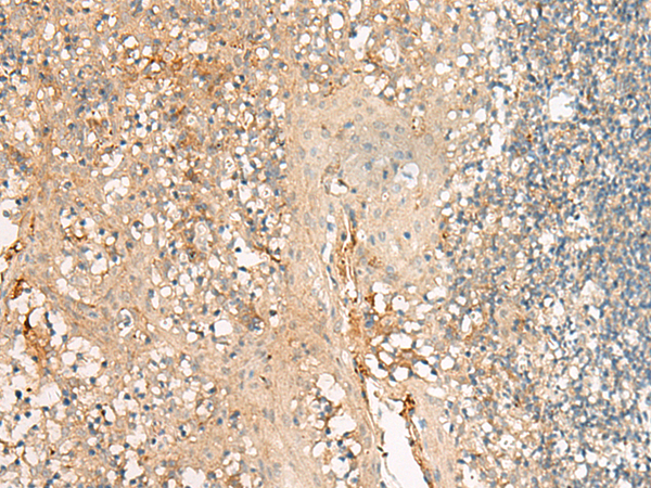 Immunohistochemistry of paraffin-embedded Human tonsil tissue  using GPR27 Polyclonal Antibody at dilution of 1:25(×200)