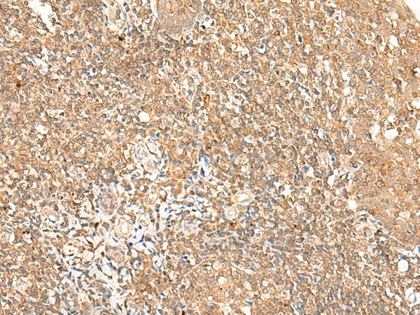 Immunohistochemistry of paraffin-embedded Human tonsil tissue  using GPR89A/GPR89B Polyclonal Antibody at dilution of 1:25(×200)