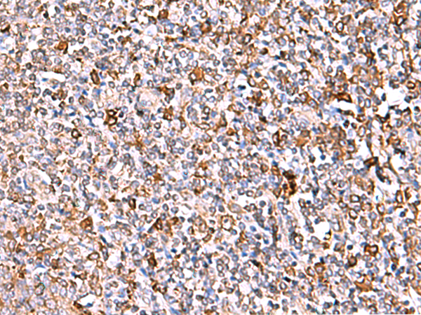 Immunohistochemistry of paraffin-embedded Human tonsil tissue  using IP6K1 Polyclonal Antibody at dilution of 1:40(×200)