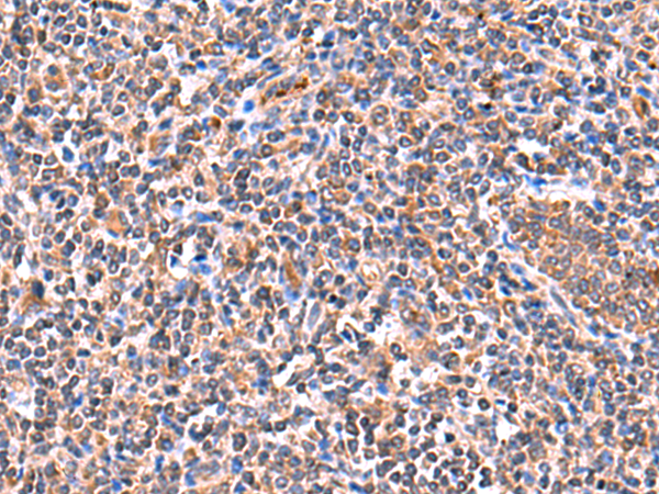 Immunohistochemistry of paraffin-embedded Human tonsil tissue  using ISM1 Polyclonal Antibody at dilution of 1:60(×200)