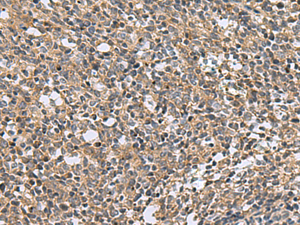 Immunohistochemistry of paraffin-embedded Human tonsil tissue  using EARS2 Polyclonal Antibody at dilution of 1:30(×200)