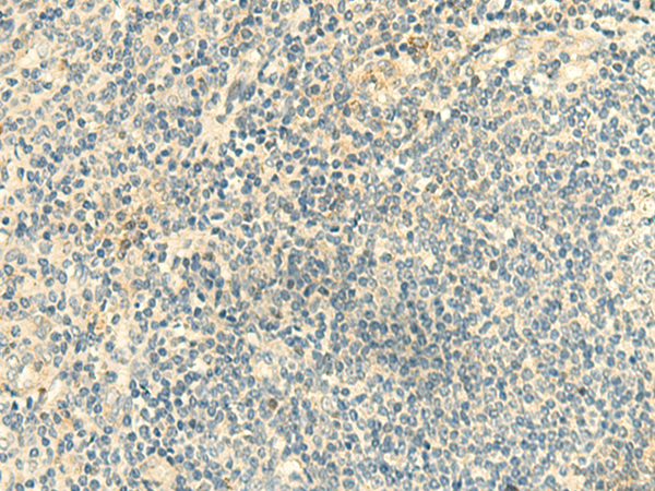 Immunohistochemistry of paraffin-embedded Human tonsil tissue  using CLEC10A Polyclonal Antibody at dilution of 1:50(×200)