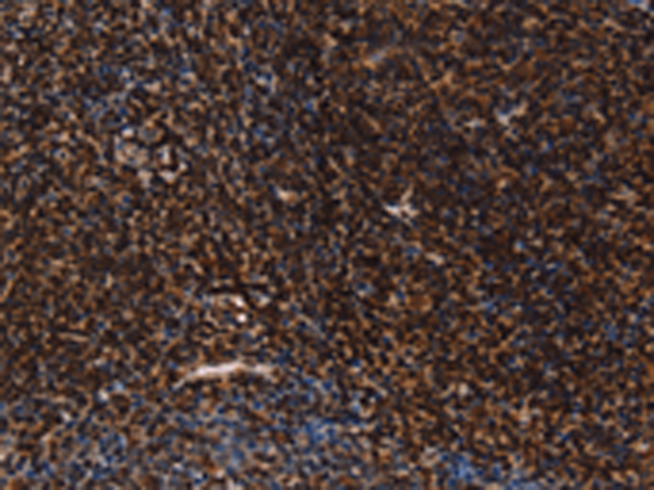 Immunohistochemistry of paraffin-embedded Human tonsil tissue  using LMNB1 Polyclonal Antibody at dilution of 1:60(×200)