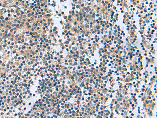 Immunohistochemistry of paraffin-embedded Human tonsil tissue  using RGS2 Polyclonal Antibody at dilution of 1:95(×200)