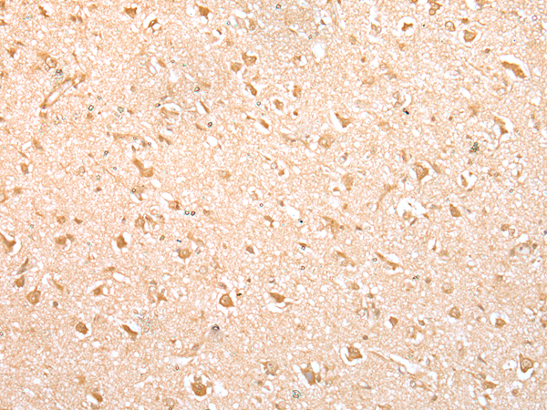 Immunohistochemistry of paraffin-embedded Human brain tissue  using MED6 Polyclonal Antibody at dilution of 1:30(×200)