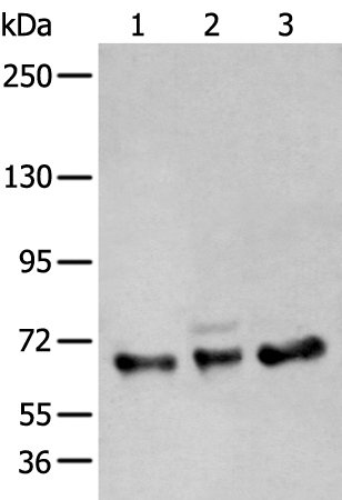 Western blot analysis of A431 K562 and TM4 cell lysates  using ZBTB5 Polyclonal Antibody at dilution of 1:400