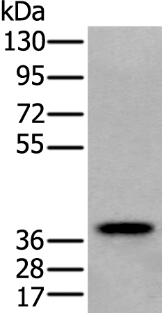 Western blot analysis of Human testis tissue lysate  using ZPBP Polyclonal Antibody at dilution of 1:250