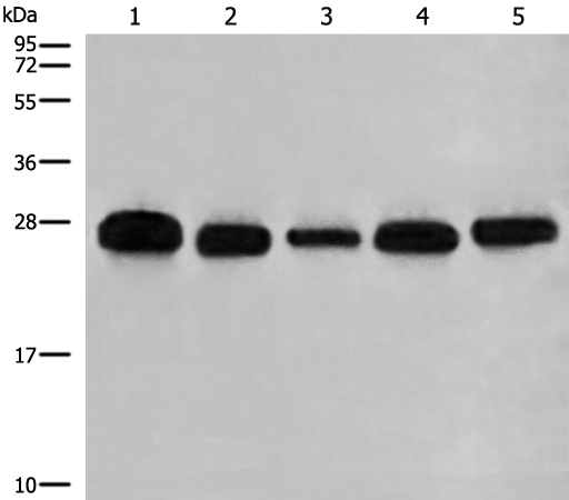 Western blot analysis of 293T A549 Hela K562 and HEPG2 cell lysates  using GATD3B Polyclonal Antibody at dilution of 1:400