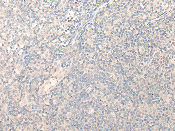 Immunohistochemistry of paraffin-embedded Human tonsil tissue  using RADIL Polyclonal Antibody at dilution of 1:40(×200)