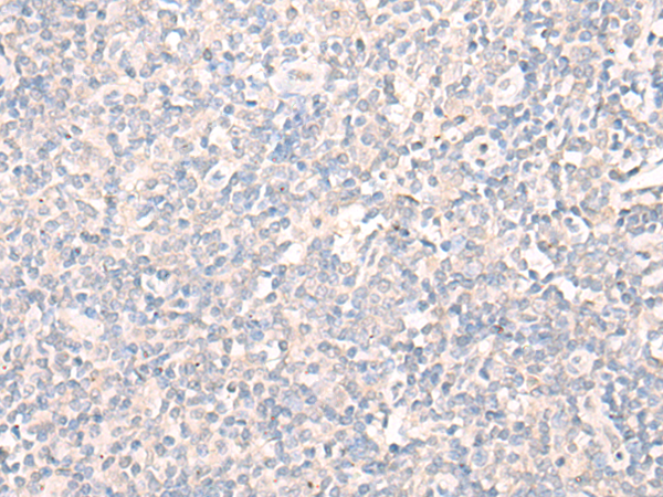 Immunohistochemistry of paraffin-embedded Human tonsil tissue  using LILRA2 Polyclonal Antibody at dilution of 1:40(×200)