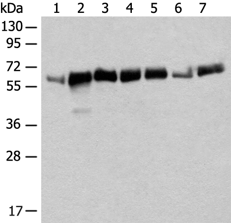 Western blot analysis of Mouse heart tissue Mouse liver tissue NIH/3T3 cell Human bladder transitional cell carcinoma grade 2-3 tissue A172 cell Human placenta tissue K562 cell lysates  using CCDC47 Polyclonal Antibody at dilution of 1:350