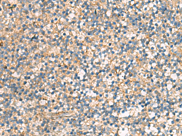 Immunohistochemistry of paraffin-embedded Human tonsil tissue  using KIF2C Polyclonal Antibody at dilution of 1:70(×200)