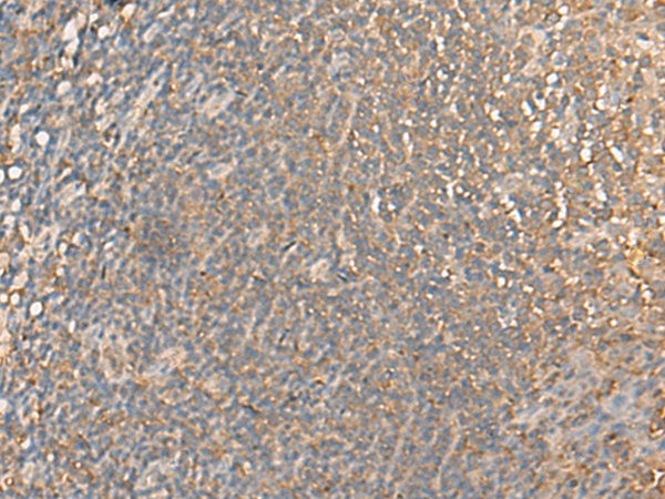 Immunohistochemistry of paraffin-embedded Human tonsil tissue  using DGLUCY Polyclonal Antibody at dilution of 1:40(×200)