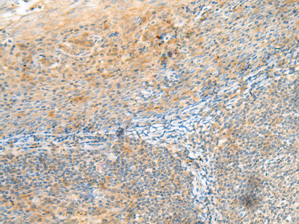 Immunohistochemistry of paraffin-embedded Human tonsil tissue  using CLEC3B Polyclonal Antibody at dilution of 1:90(×200)