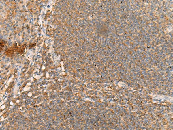 Immunohistochemistry of paraffin-embedded Human tonsil tissue  using CD48 Polyclonal Antibody at dilution of 1:95(×200)