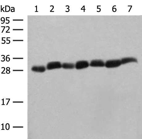 Western blot analysis of Hela cell Mouse spleen tissue Mouse liver tissue PC3 cell HL60 cell A549 cell NIH/3T3 cell lysates  using PSMA3 Polyclonal Antibody at dilution of 1:350