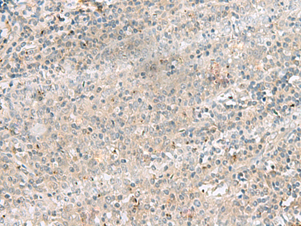 Immunohistochemistry of paraffin-embedded Human tonsil tissue  using PSMA4 Polyclonal Antibody at dilution of 1:45(×200)