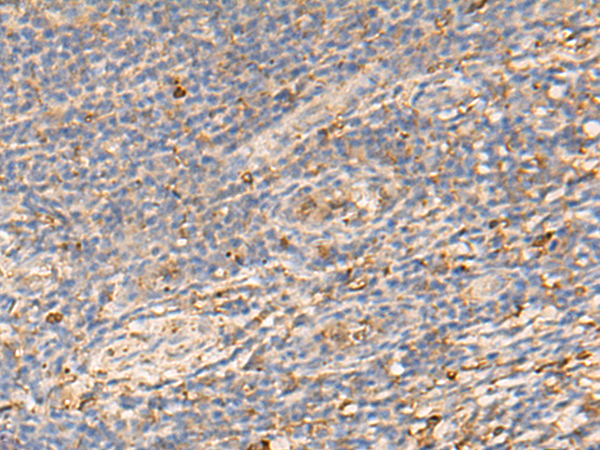 Immunohistochemistry of paraffin-embedded Human tonsil tissue  using PDIA5 Polyclonal Antibody at dilution of 1:50(×200)