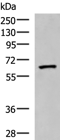Western blot analysis of Human placenta tissue lysate  using PDIA5 Polyclonal Antibody at dilution of 1:1000