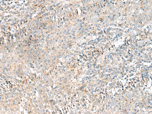 Immunohistochemistry of paraffin-embedded Human tonsil tissue  using CTRB1 Polyclonal Antibody at dilution of 1:55(×200)