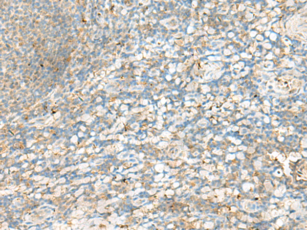 Immunohistochemistry of paraffin-embedded Human tonsil tissue  using HLA-DRB4 Polyclonal Antibody at dilution of 1:60(×200)