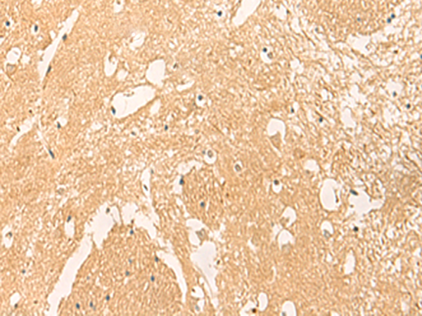 Immunohistochemistry of paraffin-embedded Human brain tissue  using STK32C Polyclonal Antibody at dilution of 1:40(×200)