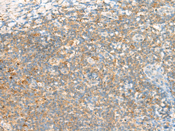 Immunohistochemistry of paraffin-embedded Human tonsil tissue  using TTLL1 Polyclonal Antibody at dilution of 1:60(×200)