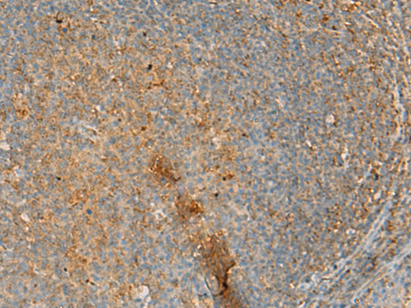 Immunohistochemistry of paraffin-embedded Human tonsil tissue  using ERAL1 Polyclonal Antibody at dilution of 1:50(×200)