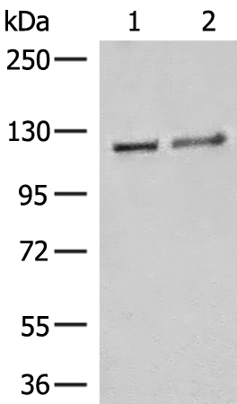 Western blot analysis of K562 cell Human fetal brain tissue lysates  using IPO11 Polyclonal Antibody at dilution of 1:500