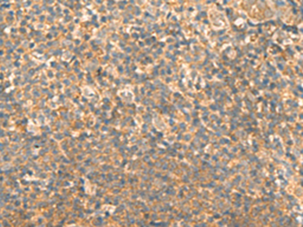 Immunohistochemistry of paraffin-embedded Human tonsil tissue  using EMC1 Polyclonal Antibody at dilution of 1:40(×200)