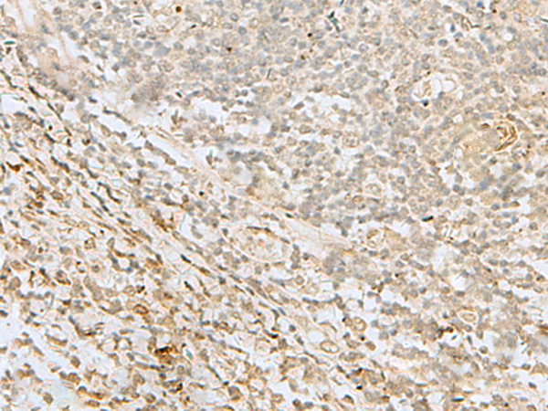 Immunohistochemistry of paraffin-embedded Human tonsil tissue  using LYRM1 Polyclonal Antibody at dilution of 1:50(×200)