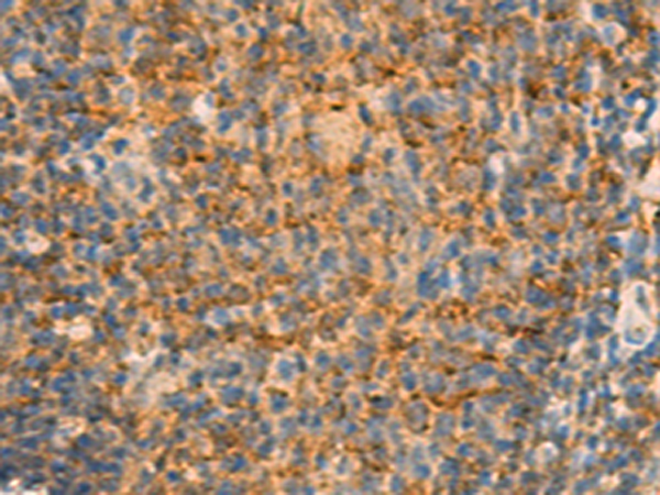 Immunohistochemistry of paraffin-embedded Human tonsil tissue  using IFITM2 Polyclonal Antibody at dilution of 1:25(×200)
