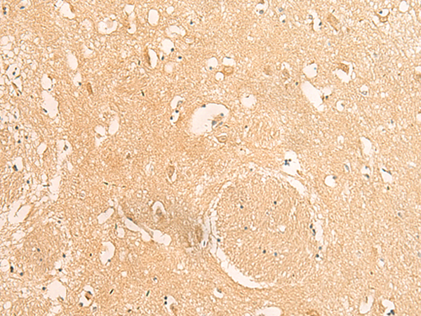 Immunohistochemistry of paraffin-embedded Human brain tissue  using IFITM2 Polyclonal Antibody at dilution of 1:25(×200)