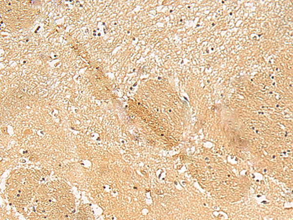 Immunohistochemistry of paraffin-embedded Human brain tissue  using TXNDC12 Polyclonal Antibody at dilution of 1:50(×200)