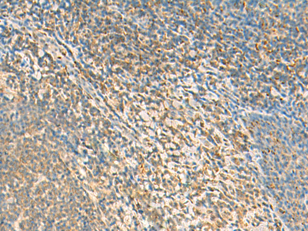 Immunohistochemistry of paraffin-embedded Human tonsil tissue  using TXNDC12 Polyclonal Antibody at dilution of 1:50(×200)