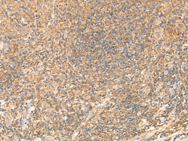 Immunohistochemistry of paraffin-embedded Human tonsil tissue  using PDAP1 Polyclonal Antibody at dilution of 1:50(×200)