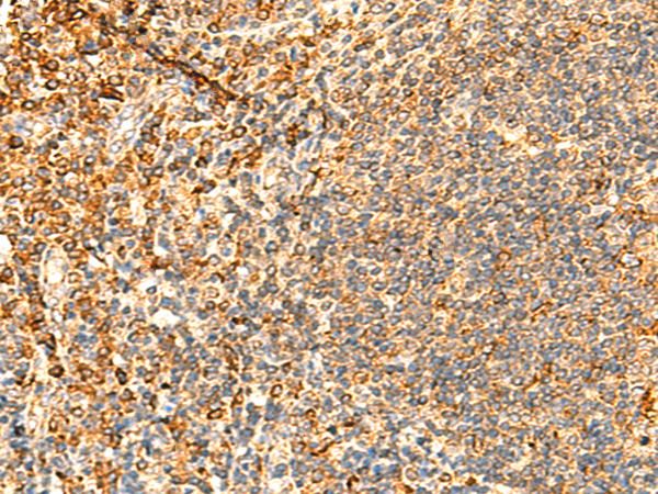 Immunohistochemistry of paraffin-embedded Human tonsil tissue  using PPM1B Polyclonal Antibody at dilution of 1:50(×200)