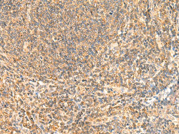 Immunohistochemistry of paraffin-embedded Human tonsil tissue  using ZNF581 Polyclonal Antibody at dilution of 1:50(×200)