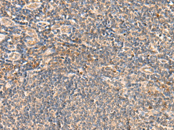 Immunohistochemistry of paraffin-embedded Human tonsil tissue  using SEC22B Polyclonal Antibody at dilution of 1:60(×200)