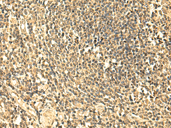 Immunohistochemistry of paraffin-embedded Human tonsil tissue  using UNKL Polyclonal Antibody at dilution of 1:50(×200)