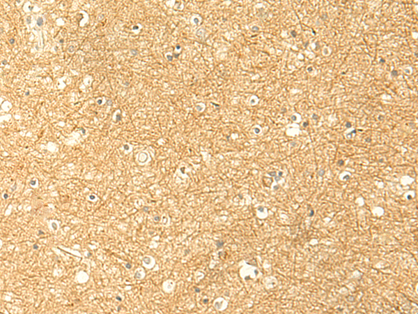 Immunohistochemistry of paraffin-embedded Human brain tissue  using RNF148 Polyclonal Antibody at dilution of 1:50(×200)