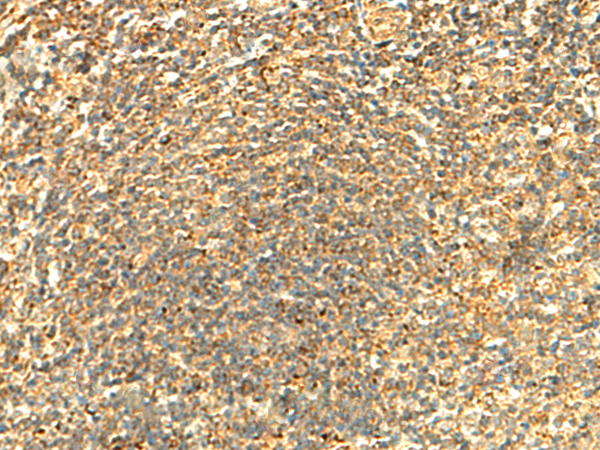 Immunohistochemistry of paraffin-embedded Human tonsil tissue  using ABHD10 Polyclonal Antibody at dilution of 1:50(×200)