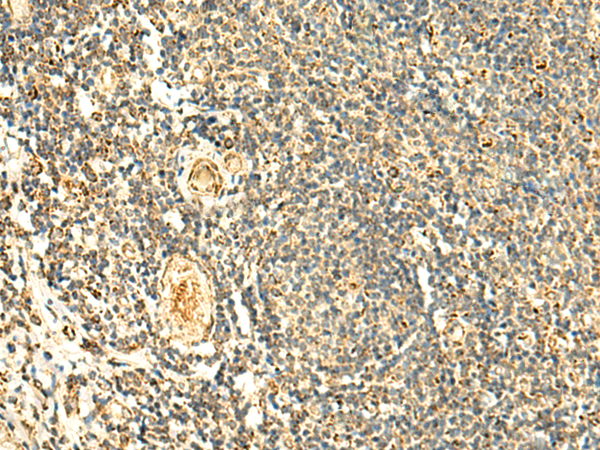 Immunohistochemistry of paraffin-embedded Human tonsil tissue  using ATP5PD Polyclonal Antibody at dilution of 1:50(×200)