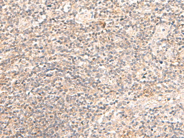 Immunohistochemistry of paraffin-embedded Human tonsil tissue  using TRAPPC1 Polyclonal Antibody at dilution of 1:50(×200)